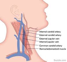 EXPLANT - Jugular veins and carotids