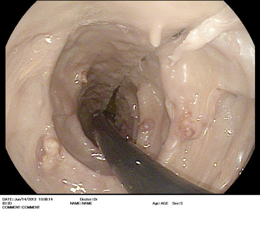 SYNTHETIC MODEL - Upper GI Model with Esophagus / Stomach / Duodenum / Biliary Sphincter