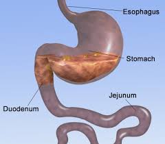 EXPLANT - Duodenal/ jejunal Intestine (sectional)